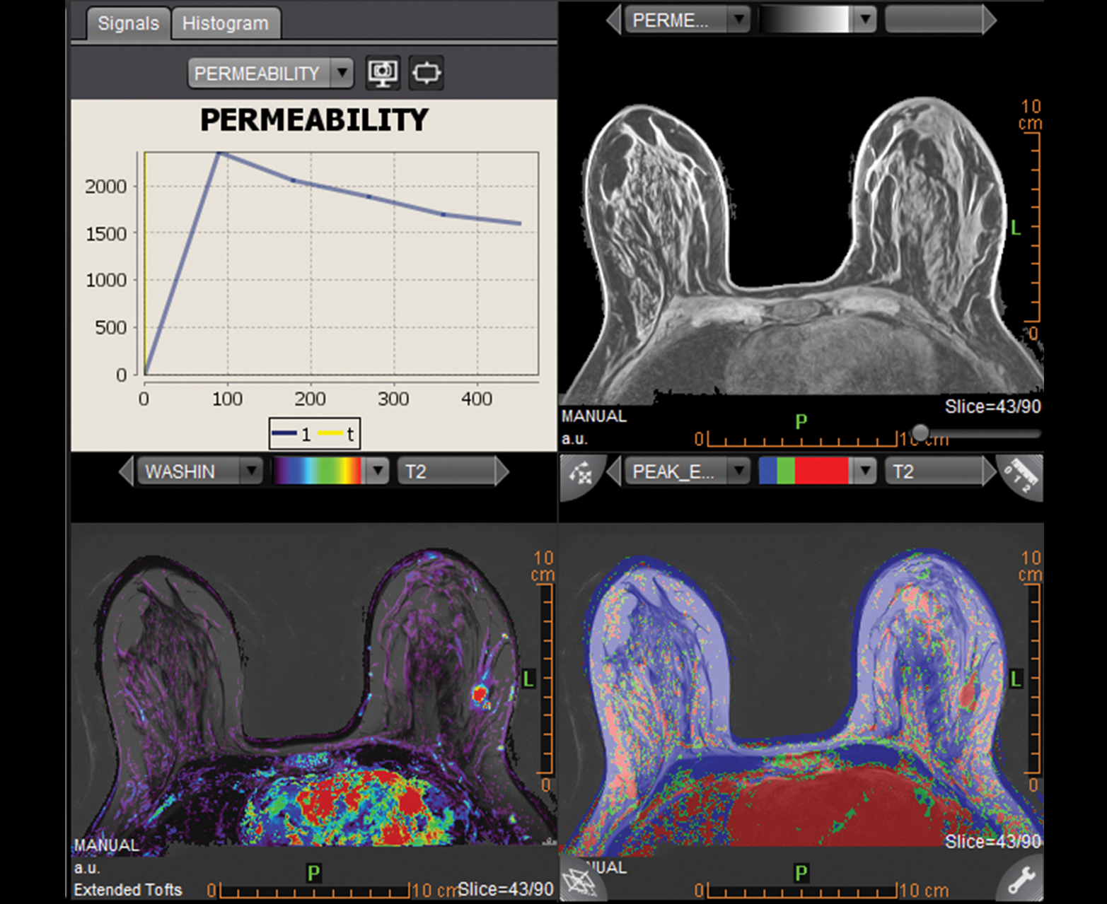 Multiparametric view and analysis tools for a quick lesion characterization