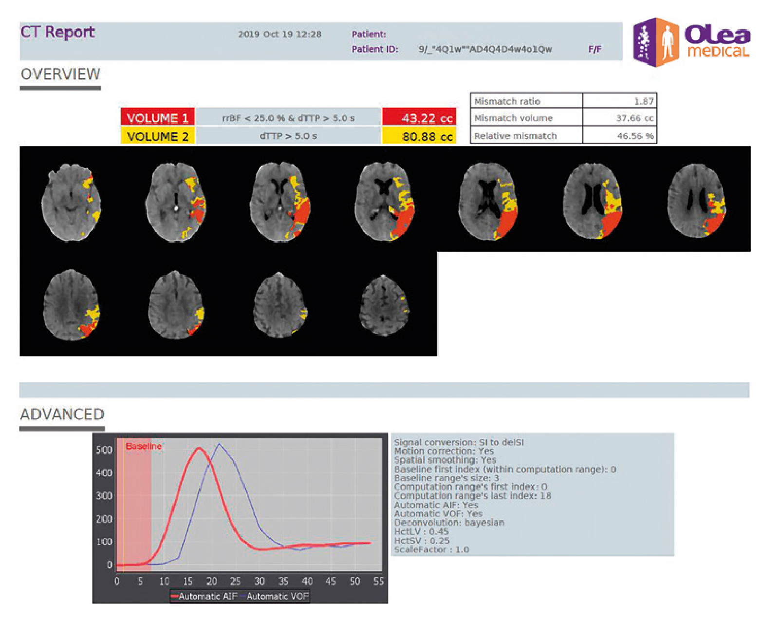 Instant and standardized stroke report with automatic mismatch computation