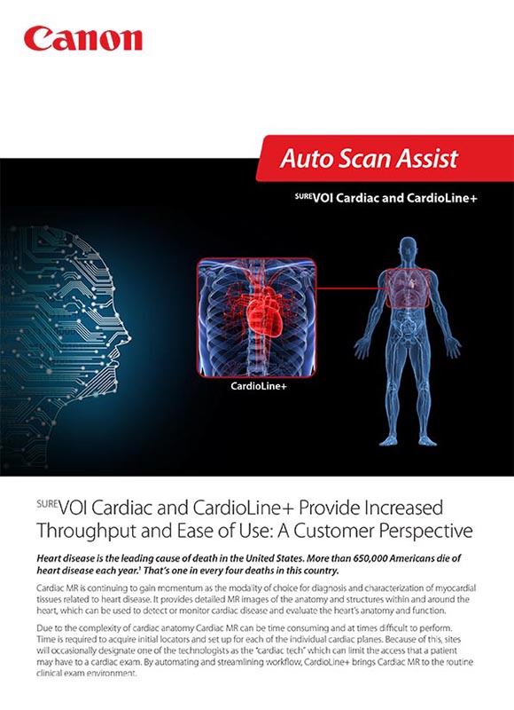 SUREVOI Cardiac and CardioLine+ Provide Increased Throughput and Ease of Use: A Customer Perspective