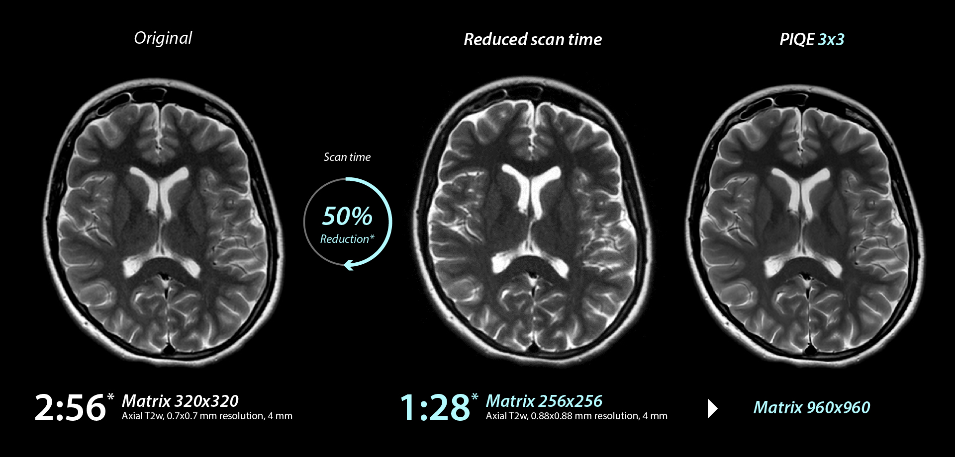 Brain: Scan Time 50% Reduction*
