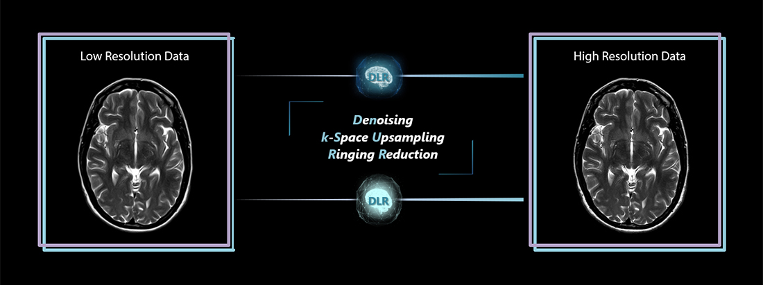 Denoising k-Space Upsampling Ringing Reduction