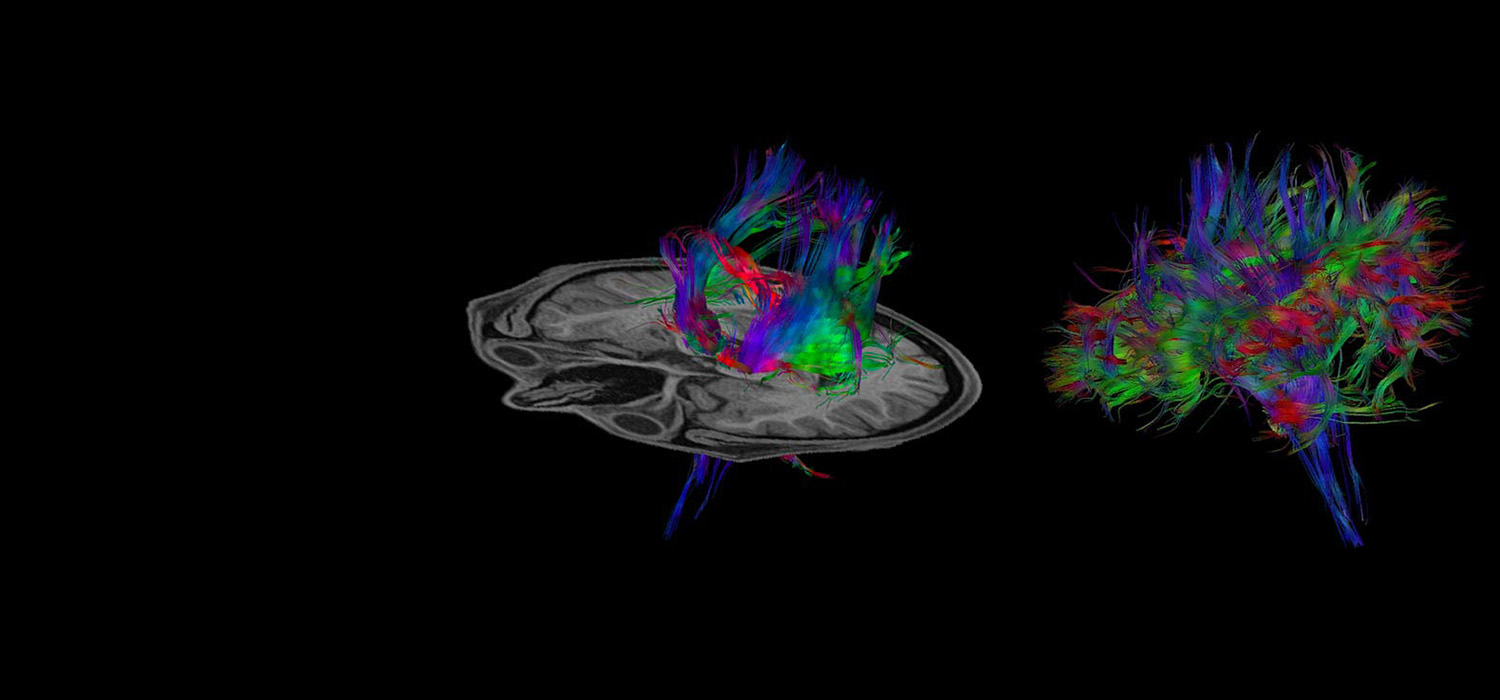 Vantage Elan 1.5T Head and Neck Clinical Images