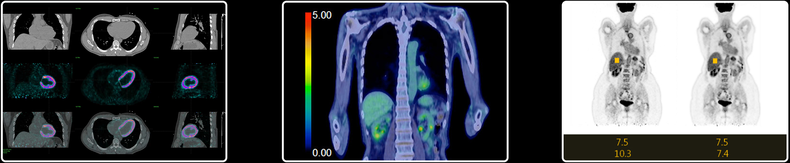Celesteion PET-CT Scanner Clinical Image