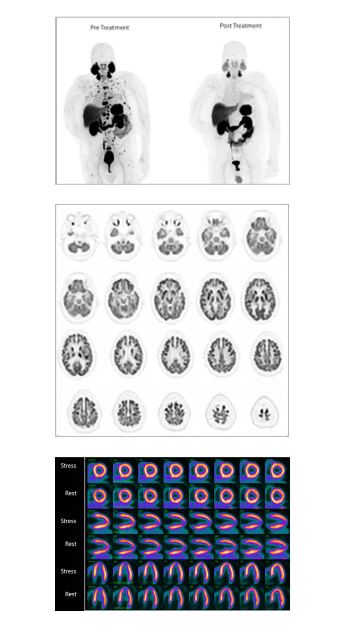 PET Imaging Examples