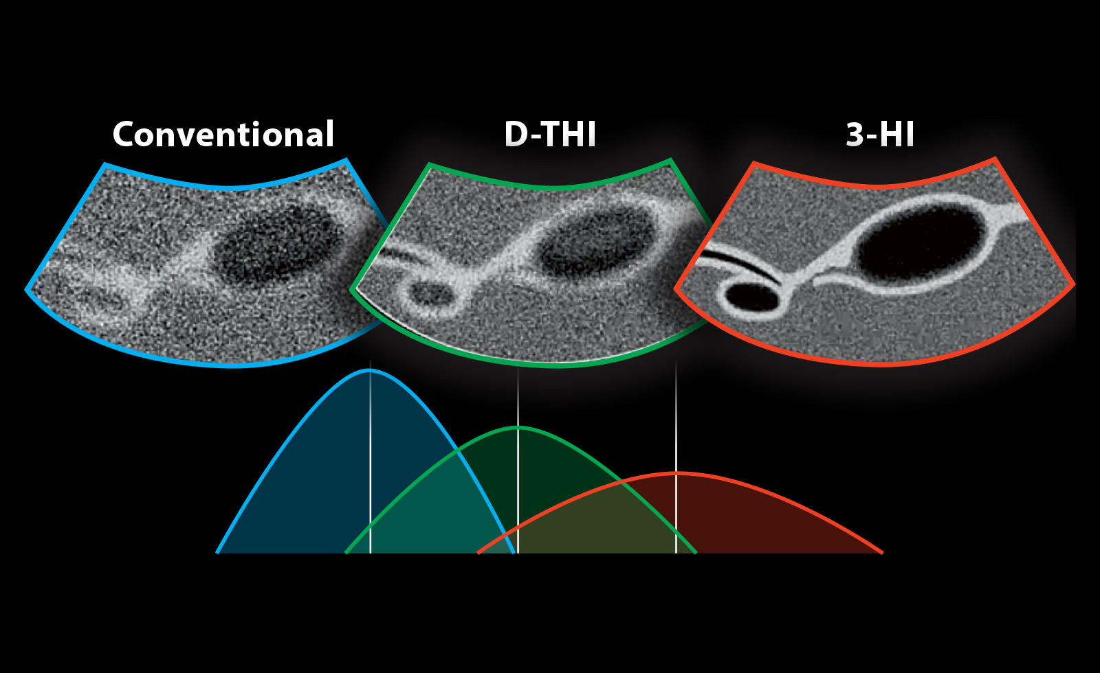 3-HI Overview