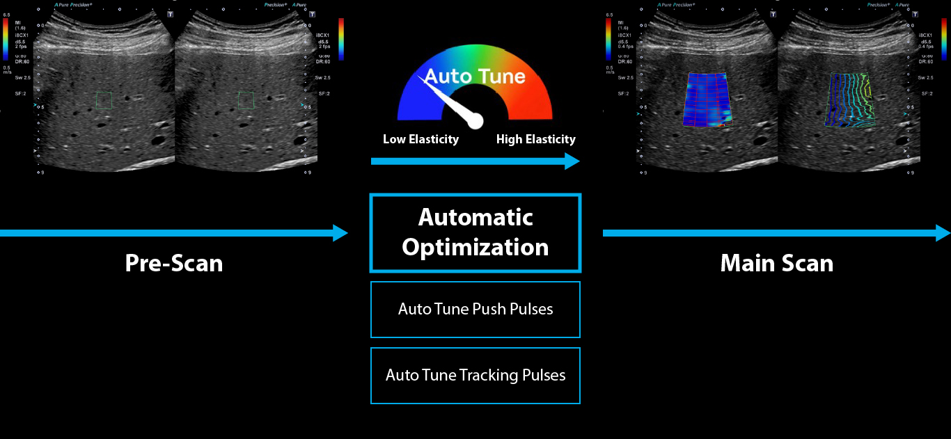 Auto Tune Shear Wave Diagram