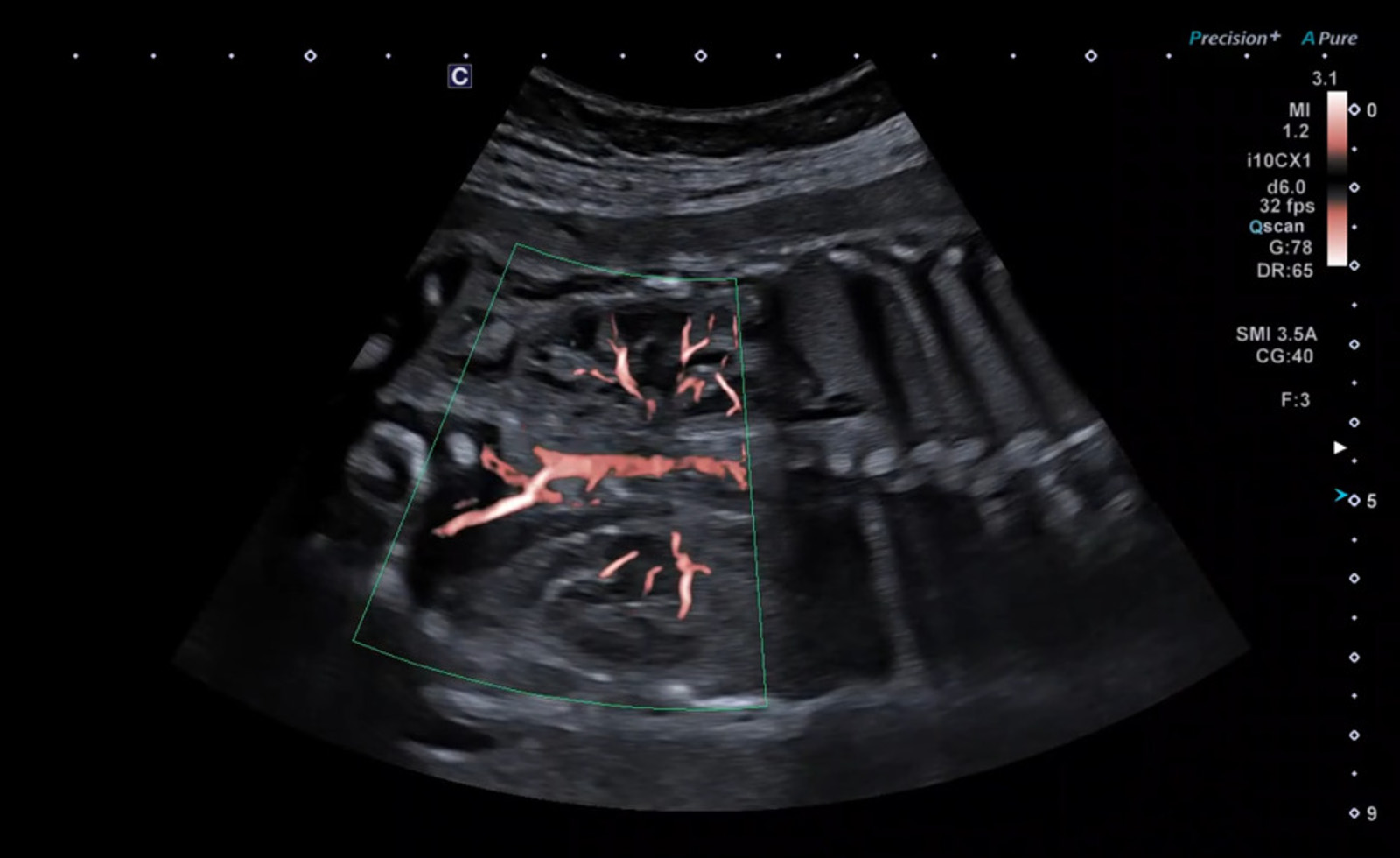 Fetal Kidney