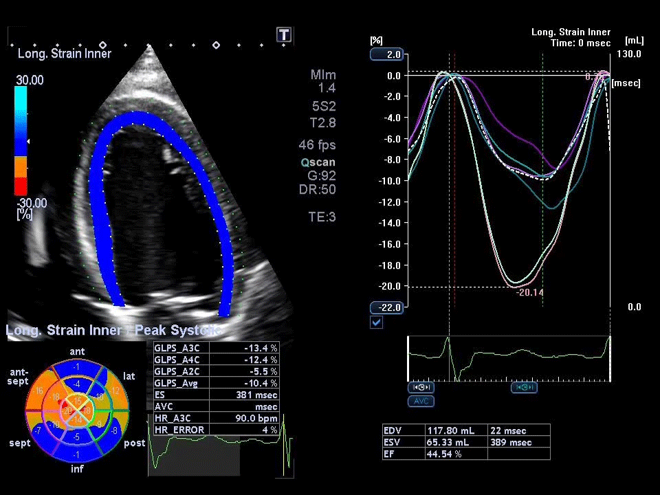 cardiovascular ultrasound