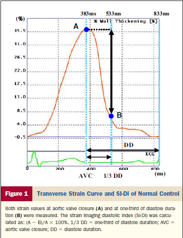 DSI： Diastolic Strain ratio Imaging Diastolic Strain ratio = (A-B)/A*100 [%]
