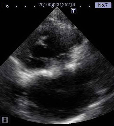 Border definition and clarity of structures for Ultrasound diagnosis