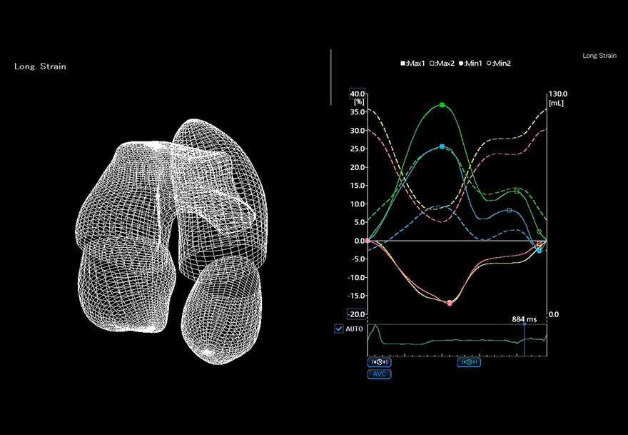 Quad Chamber Analysis Wire