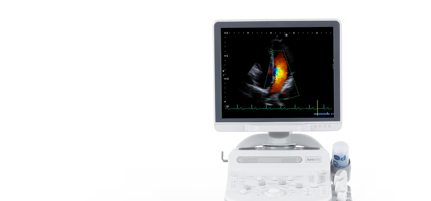 Xario 100 Ultrasound Machine Clinical Image