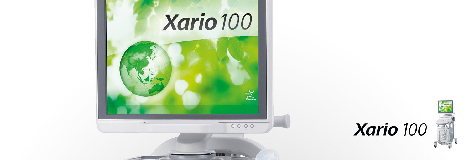 Xario 100 Ultrasound Experience
