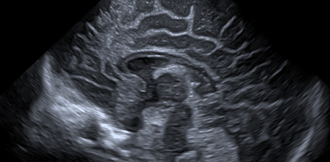 Xario 100 Ultrasound Clinical Images