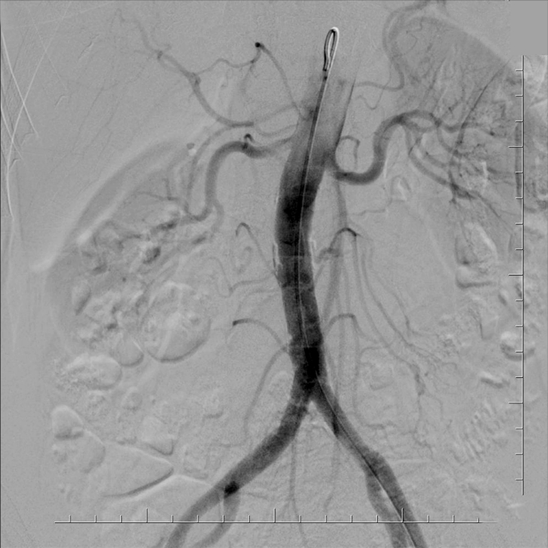 Angiography, Fluoroscopy, and Radiography Clinical Gallery
