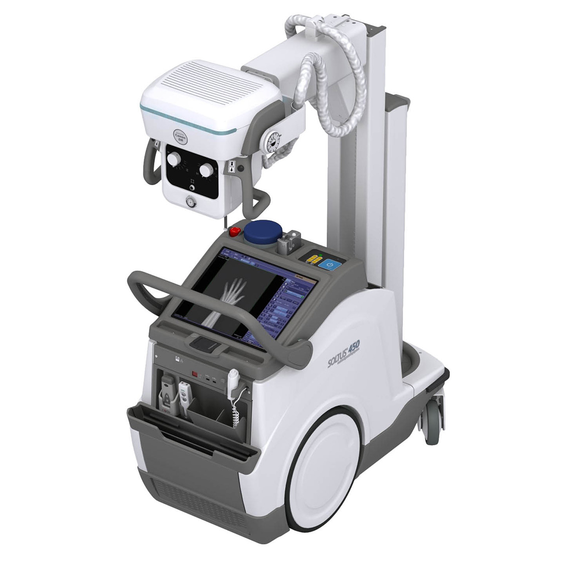 SOLTUS 450 Mobile Digital X-ray Systems