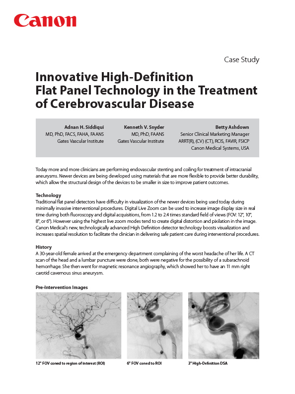 Innovative High-Definition Flat Panel Technology in the Treatment of Cerebrovascular Disease