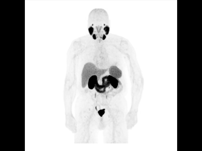 PET-CT Video