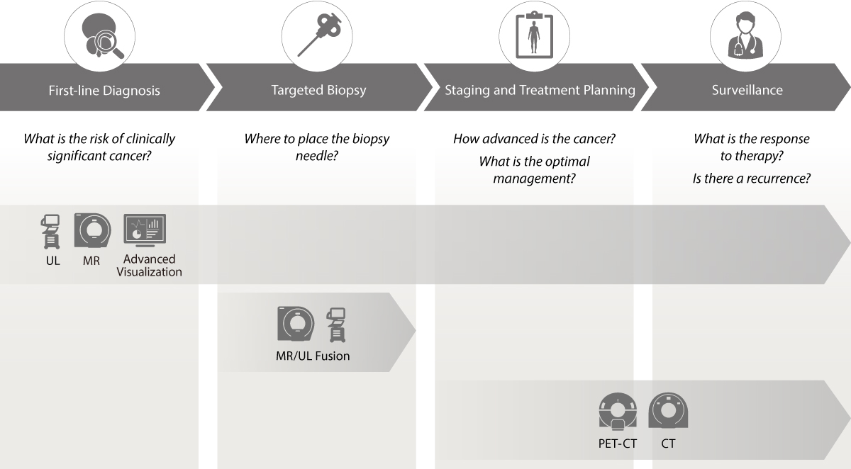 Prostate Cancer Pathway